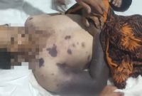 Seorang warga Kalanganyar, Lebak, meninggal dunia setelah mengalami gigitan ular. Keluarga korban menyoroti proses penanganan di RSUD Adjidarmo yang dinilai lambat saat korban membutuhkan perawatan darurat.