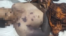 Seorang warga Kalanganyar, Lebak, meninggal dunia setelah mengalami gigitan ular. Keluarga korban menyoroti proses penanganan di RSUD Adjidarmo yang dinilai lambat saat korban membutuhkan perawatan darurat.