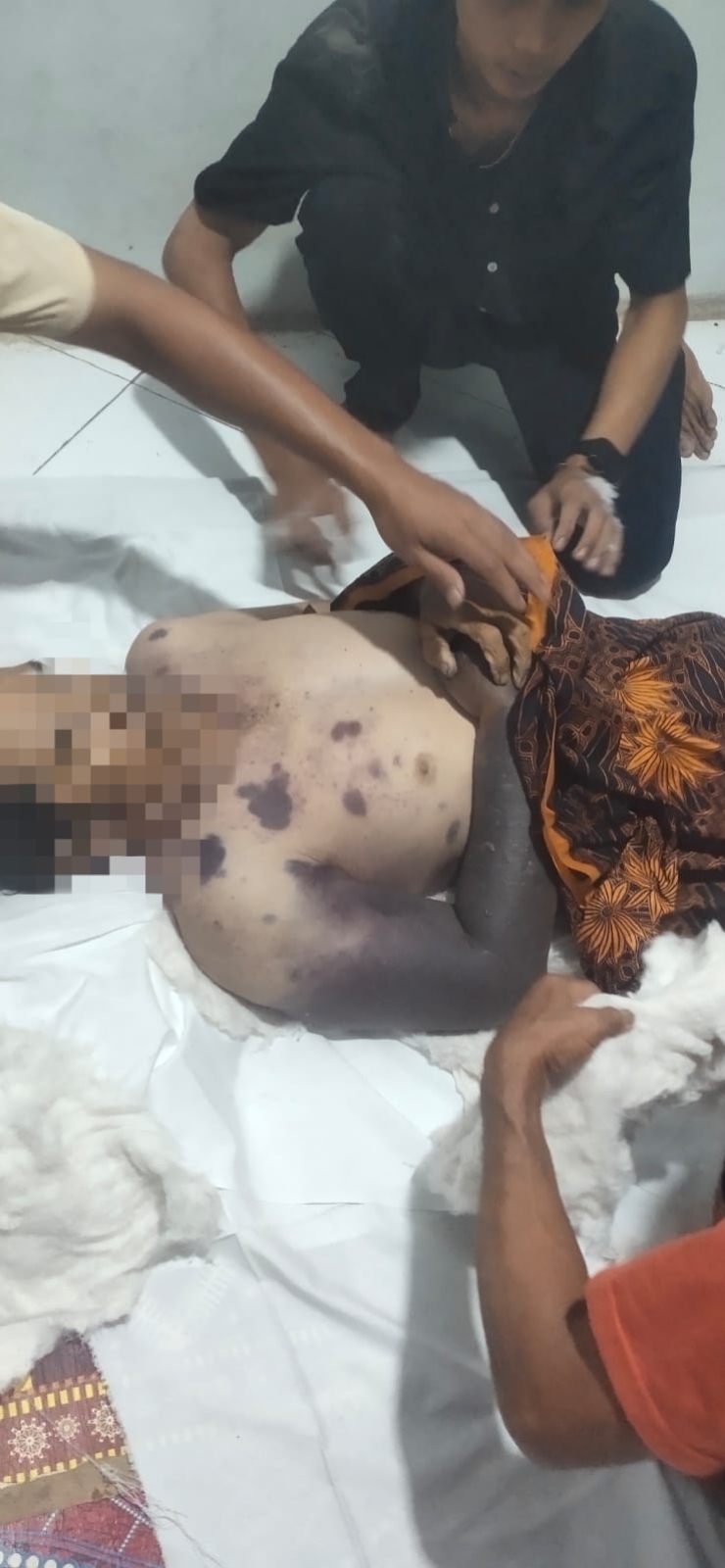 Seorang warga Kalanganyar, Lebak, meninggal dunia setelah mengalami gigitan ular. Keluarga korban menyoroti proses penanganan di RSUD Adjidarmo yang dinilai lambat saat korban membutuhkan perawatan darurat.